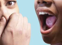 Causes and How to Cure Bad Breath Permanently in Nigeria